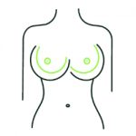 Lifting with reduction