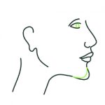 Face contouring surgery