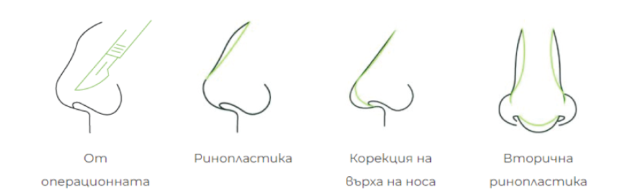 Разгледайте резултатите